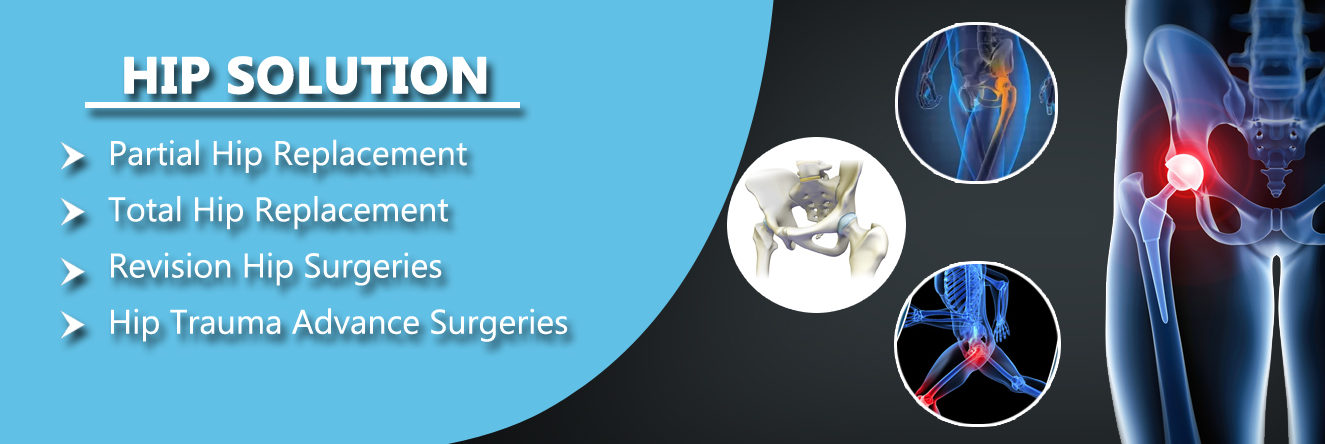 hip replacement surgeon