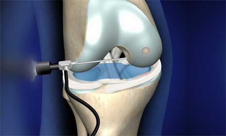 Best doctor for Orthopaedic In Indore