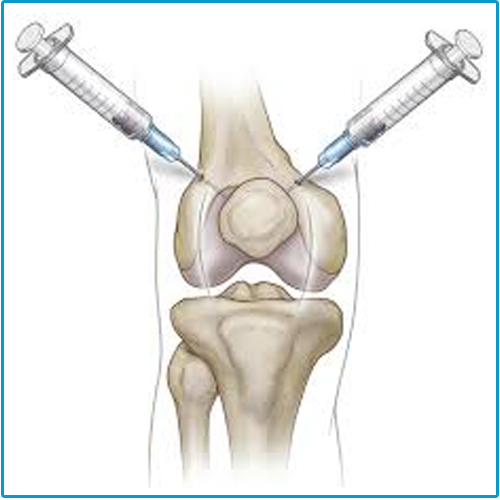 best Joint Replacement Surgery